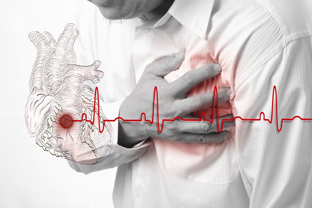 Increased risk of heart attack due to lifestyle changes